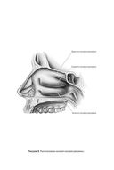 Дышите носом: Что нужно знать о самых распространенных болезнях носа и современных методах лечения — фото, картинка — 29
