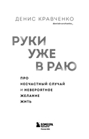 Руки уже в раю. Про несчастный случай и невероятное желание жить — фото, картинка — 10