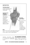 Жизнь без артрита: практическое руководство по избавлению от болей в суставах — фото, картинка — 10