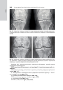 Лучевая диагностика заболеваний костей и суставов. Национальное руководство — фото, картинка — 11