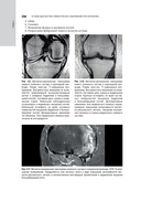 Лучевая диагностика заболеваний костей и суставов. Национальное руководство — фото, картинка — 13
