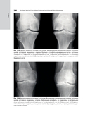 Лучевая диагностика заболеваний костей и суставов. Национальное руководство — фото, картинка — 15