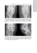 Лучевая диагностика заболеваний костей и суставов. Национальное руководство — фото, картинка — 16