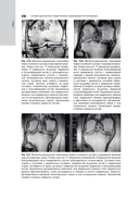 Лучевая диагностика заболеваний костей и суставов. Национальное руководство — фото, картинка — 17