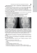 Лучевая диагностика заболеваний костей и суставов. Национальное руководство — фото, картинка — 18