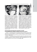 Лучевая диагностика заболеваний костей и суставов. Национальное руководство — фото, картинка — 20