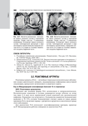 Лучевая диагностика заболеваний костей и суставов. Национальное руководство — фото, картинка — 21