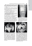 Лучевая диагностика заболеваний костей и суставов. Национальное руководство — фото, картинка — 10